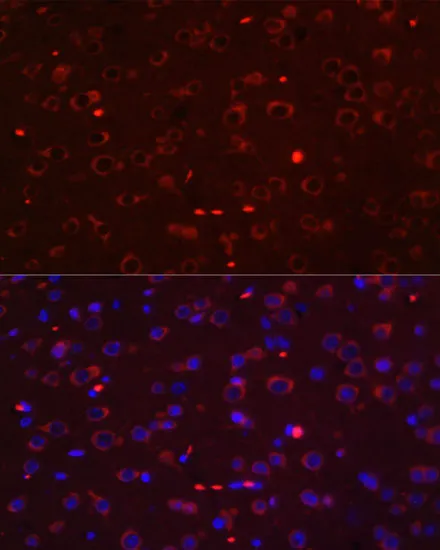 (KO Validated) STAT3 Polyclonal Antibody - image 2