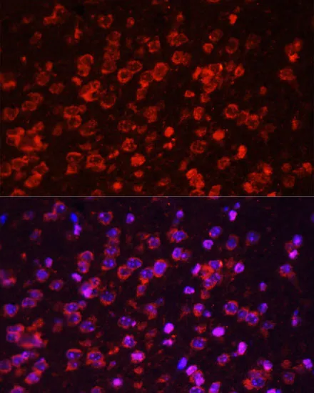 (KO Validated) STAT3 Polyclonal Antibody - image 3