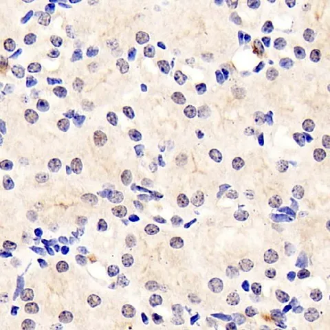 RELB Polyclonal Antibody - image 1