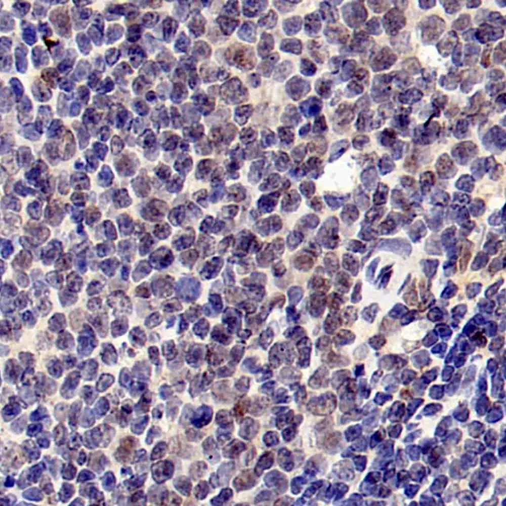 RELB Polyclonal Antibody - image 2