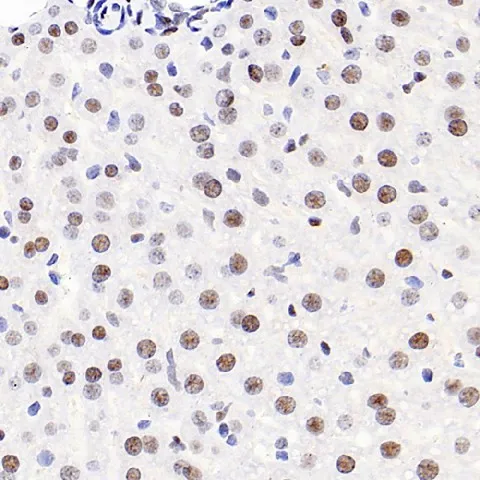 HDAC2 Polyclonal Antibody - image 1