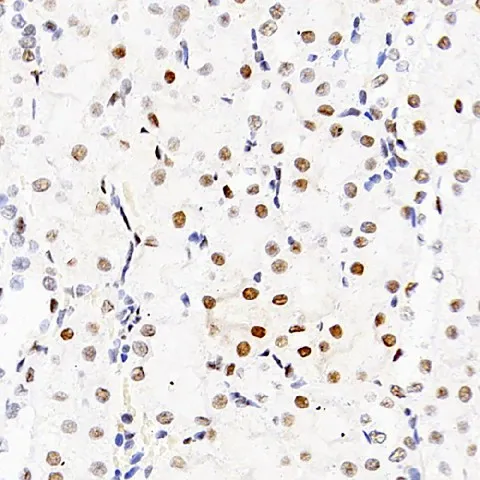 HDAC2 Polyclonal Antibody - image 2