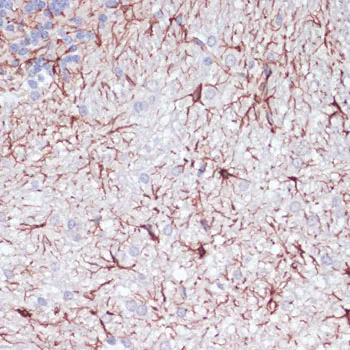 GFAP Polyclonal Antibody - image 1