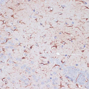 GFAP Polyclonal Antibody - image 2