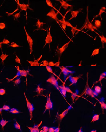 GFAP Polyclonal Antibody - image 3