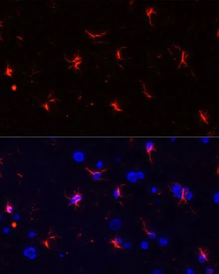 GFAP Polyclonal Antibody - image 4