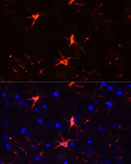 GFAP Polyclonal Antibody - image 5