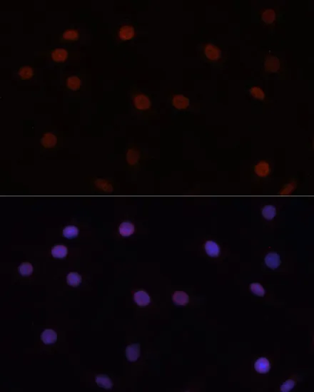 DNMT3B Polyclonal Antibody - image 1