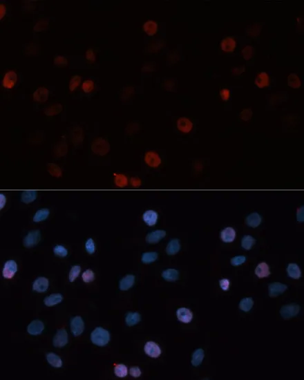 DNMT3B Polyclonal Antibody - image 2