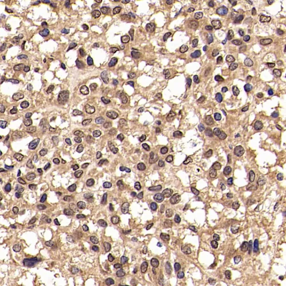 JUN Polyclonal Antibody - image 1