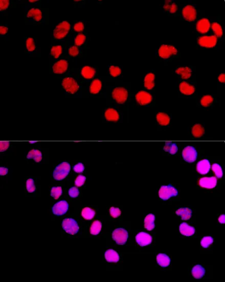 (KO Validated) DNMT1 Polyclonal Antibody - image 2