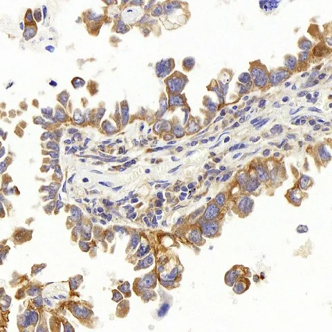 PERK Polyclonal Antibody - image 1