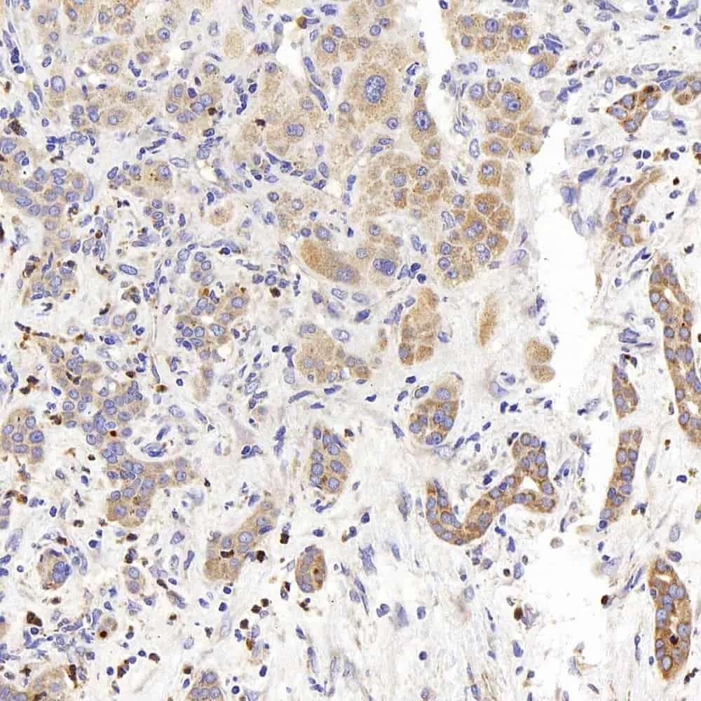 PERK Polyclonal Antibody - image 2