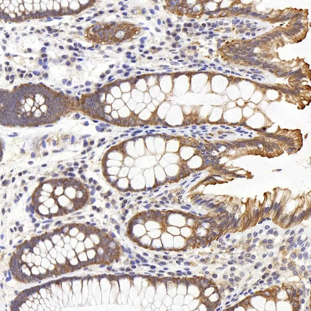 PERK Polyclonal Antibody - image 3