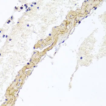 CD81 Polyclonal Antibody - image 2