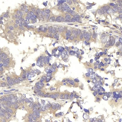 IKK alpha Polyclonal Antibody - image 1