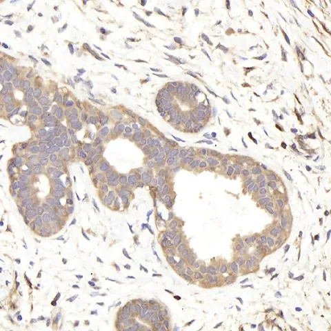 IKK alpha Polyclonal Antibody - image 2