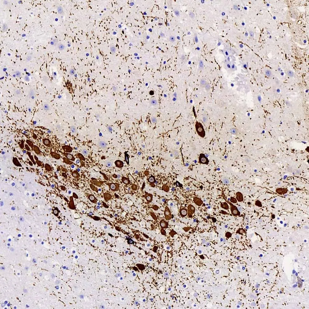 TH Polyclonal Antibody - image 1