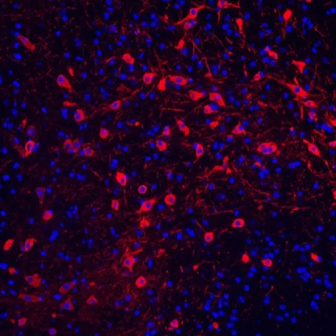 TH Polyclonal Antibody - image 3