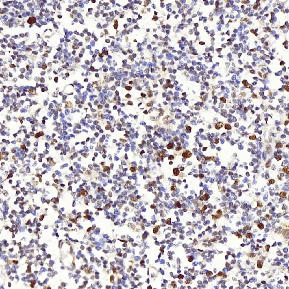 PCNA Polyclonal Antibody - image 1