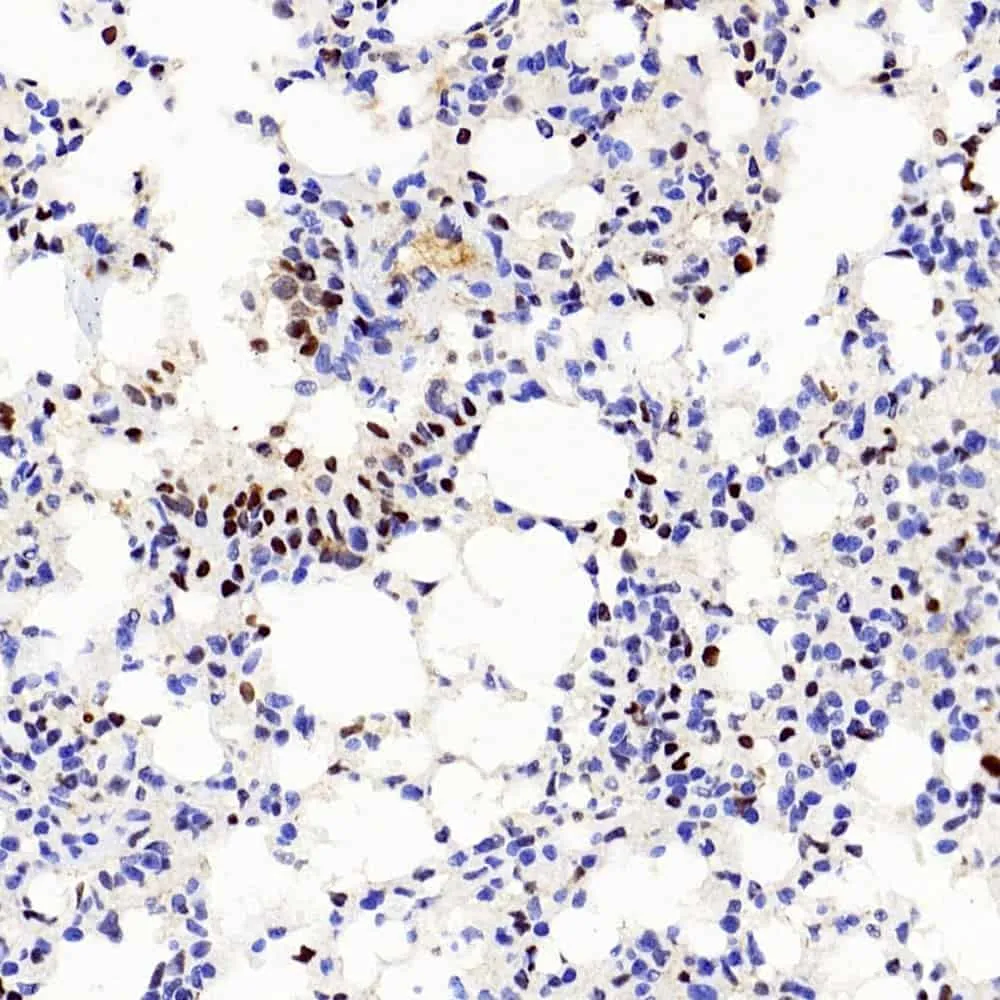 PCNA Polyclonal Antibody - image 2