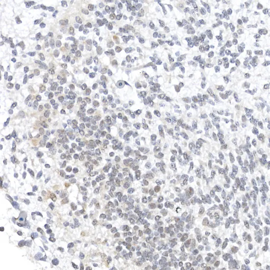 OCT4 Polyclonal Antibody - image 1