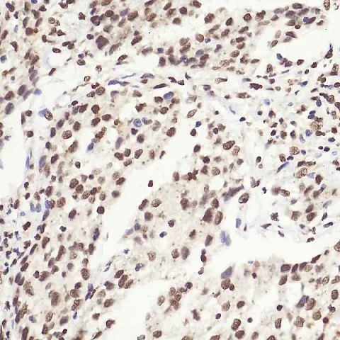 HMGB1 Polyclonal Antibody - image 1