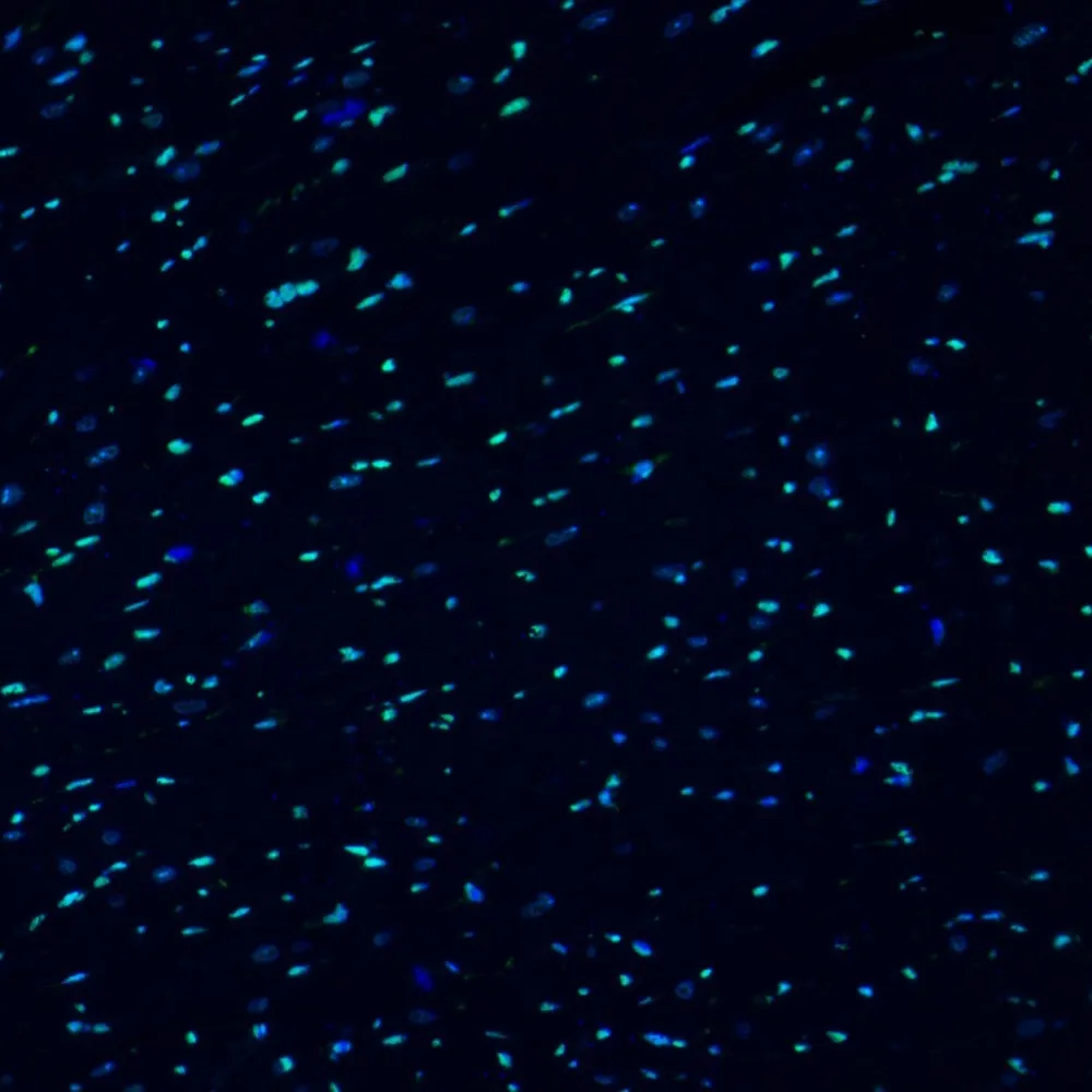 HMGB1 Polyclonal Antibody - image 3