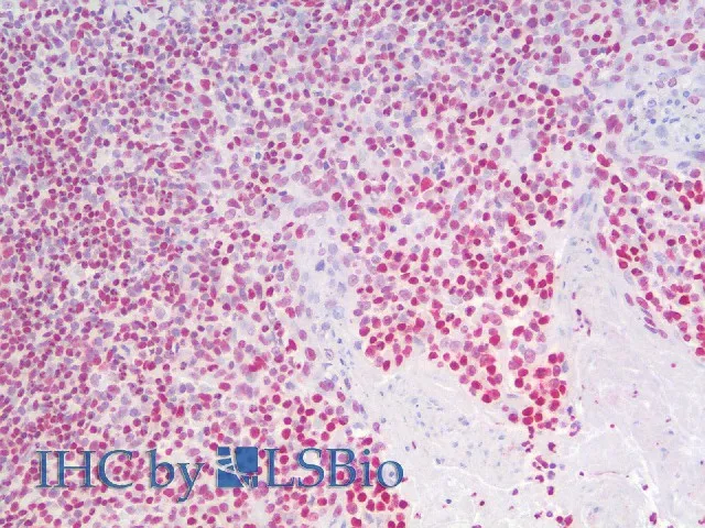 HMGB1 Polyclonal Antibody - image 4
