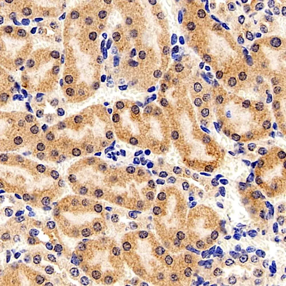 FOXO1 Polyclonal Antibody - image 1
