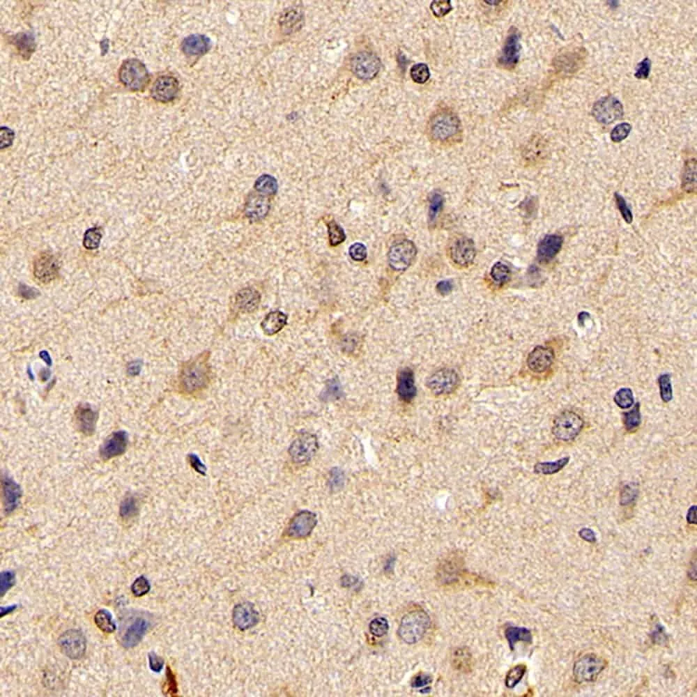 FOXO1 Polyclonal Antibody - image 2