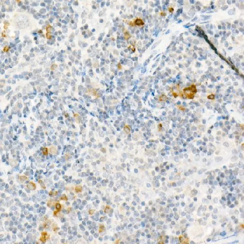 MCP-1 Polyclonal Antibody - image 3