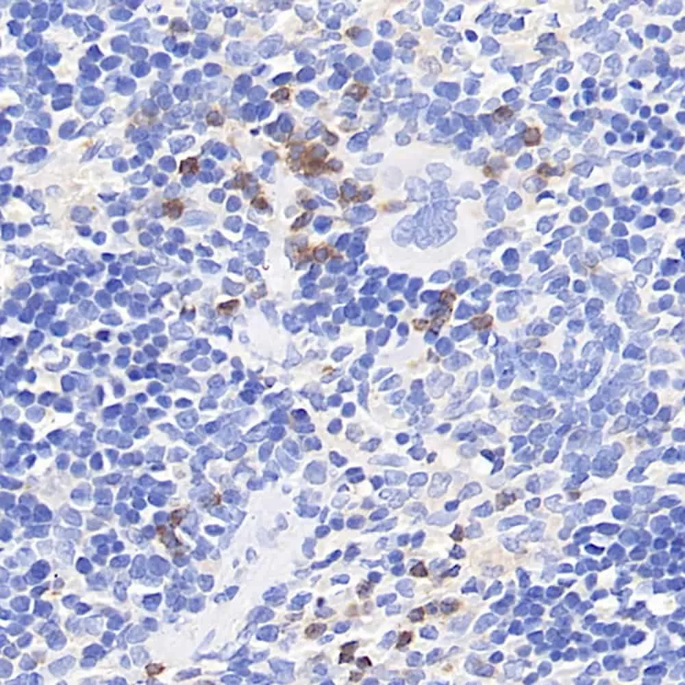 CYBB Polyclonal Antibody - image 1