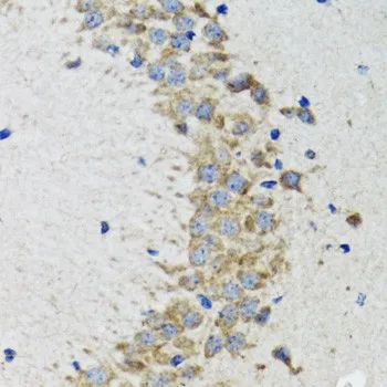 CDK1 Polyclonal Antibody - image 1