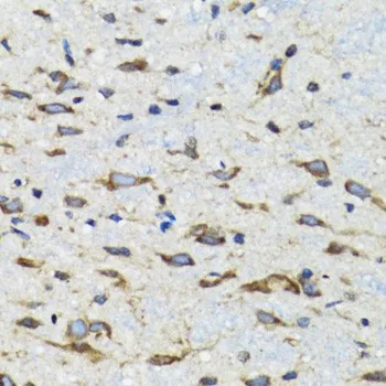CDK1 Polyclonal Antibody - image 2