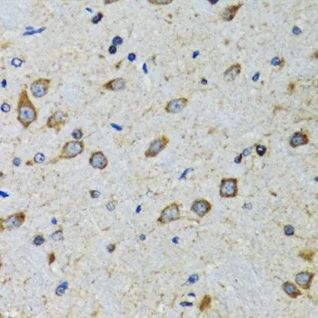 CDK1 Polyclonal Antibody - image 3