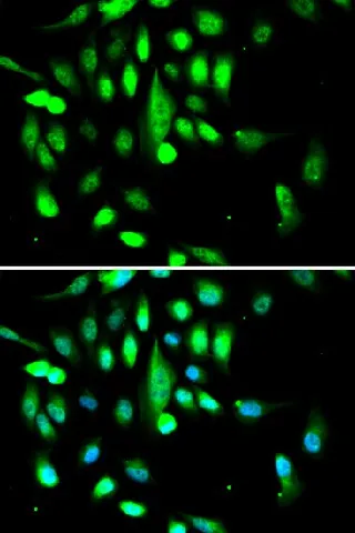 CDK1 Polyclonal Antibody - image 4