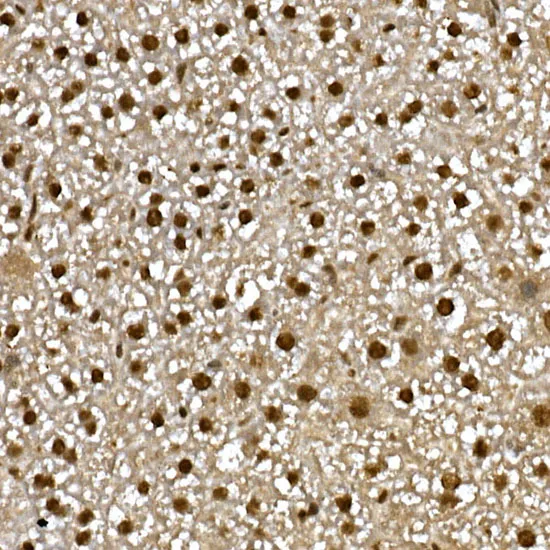 PPAR gamma Polyclonal Antibody - image 1