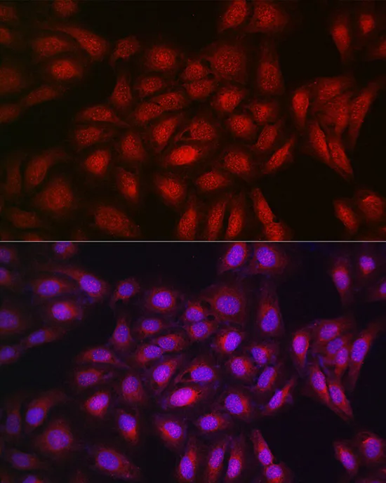 PPAR gamma Polyclonal Antibody - image 2