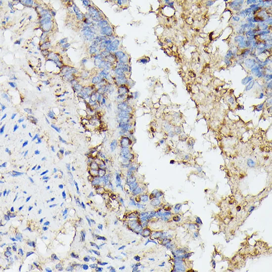 KRT14 Polyclonal Antibody - image 1