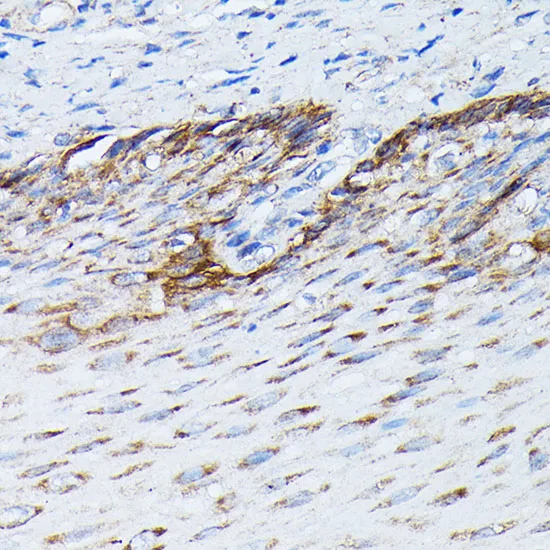 KRT14 Polyclonal Antibody - image 2