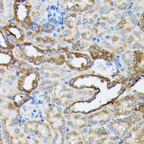 KRT14 Polyclonal Antibody - image 3