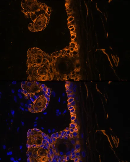 KRT14 Polyclonal Antibody - image 4