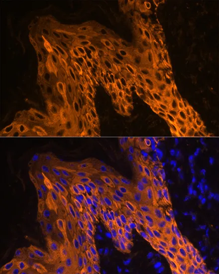 KRT14 Polyclonal Antibody - image 5