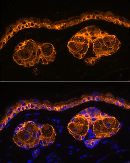 KRT14 Polyclonal Antibody - image 6