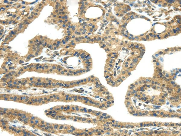 TMPRSS11E Polyclonal Antibody - image 1