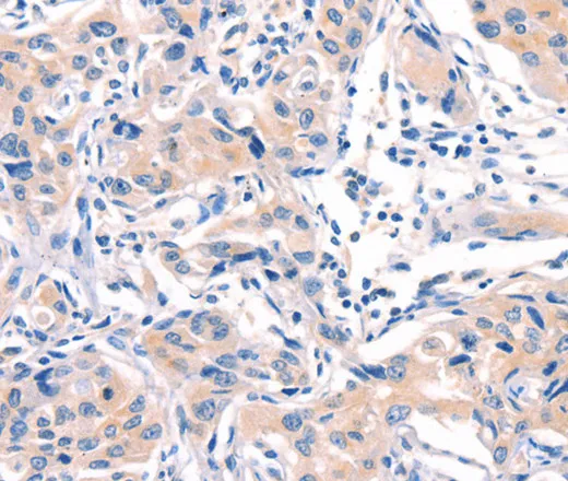 AFDN Polyclonal Antibody - image 1
