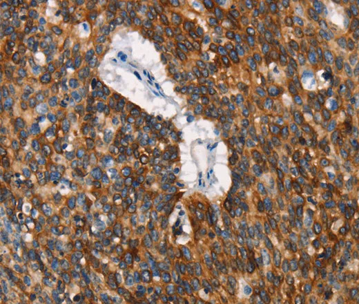 CD68 Polyclonal Antibody - image 1