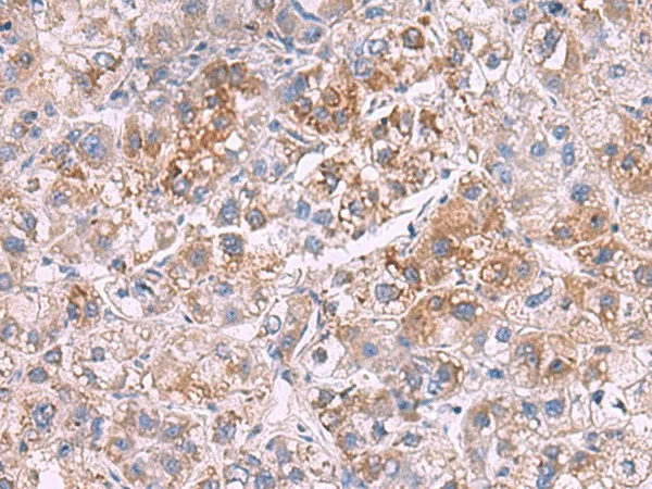 GSTCD Polyclonal Antibody - image 1