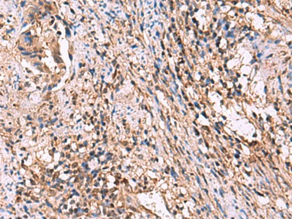 ITIH4 Polyclonal Antibody - image 1